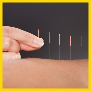acupuncture treatment - Massage Mooloolaba